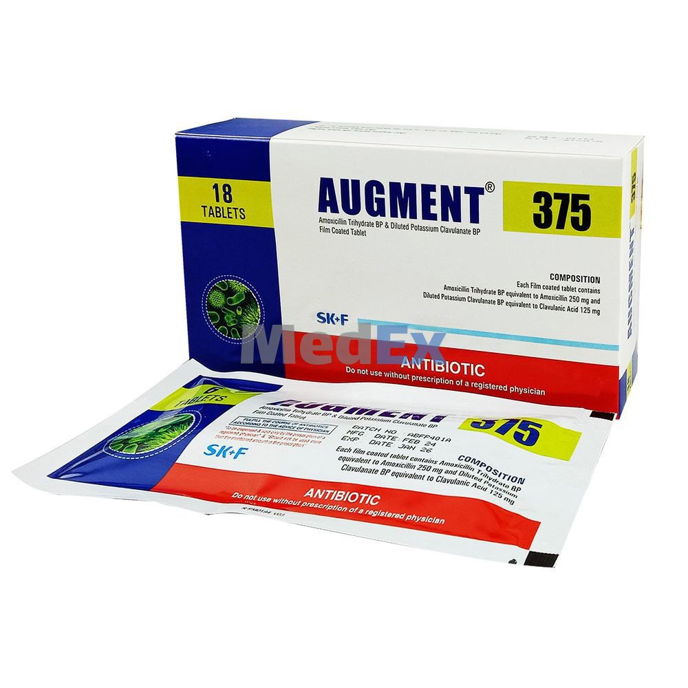 AUGMENT 375